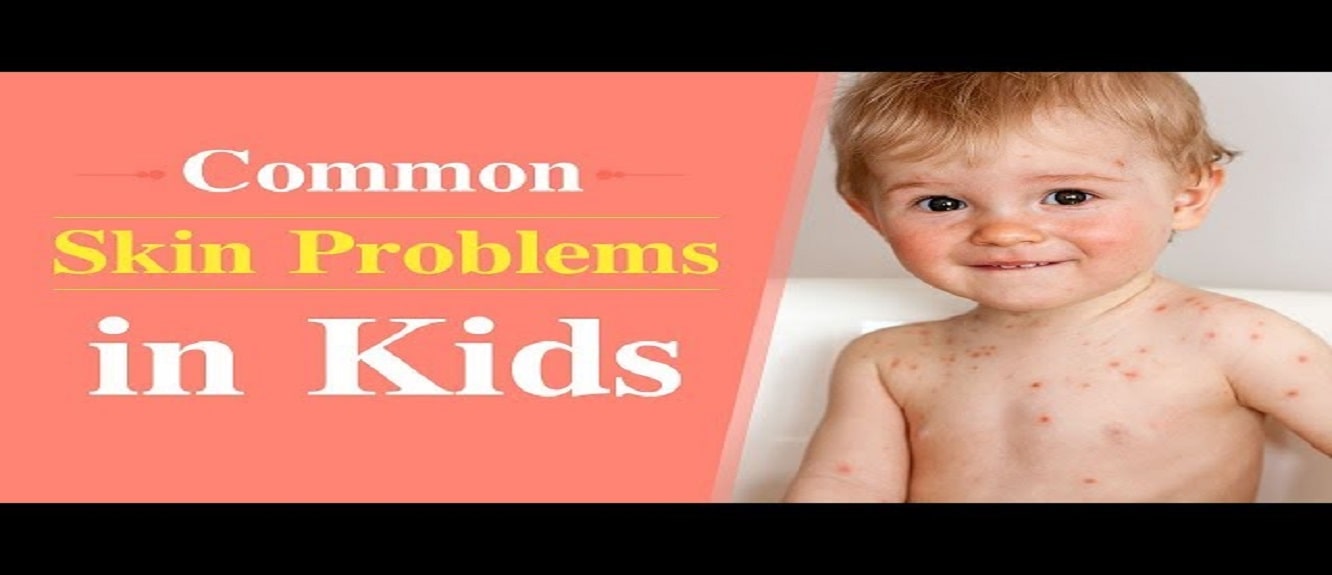 skin problem in childrens